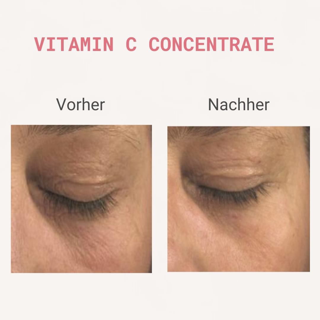 Vitamin C Concentrate - 6 Wochen Kit